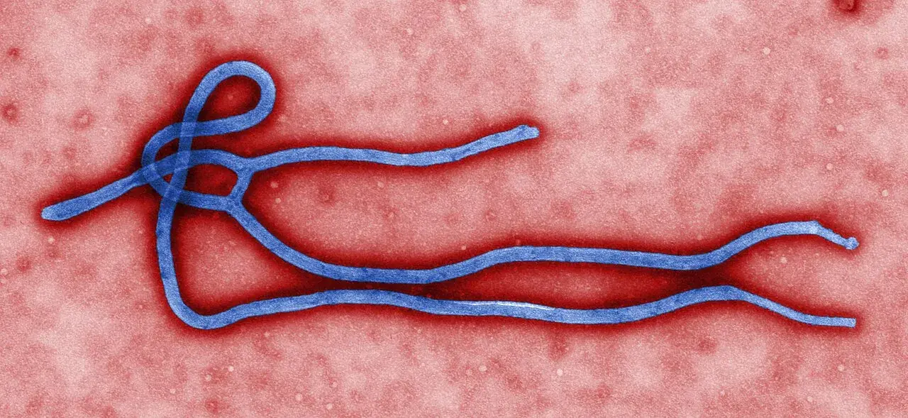 Farvelagt transmissionselektronmikroskopi (TEM) af en Ebola-viruspartikel (virion). Billedet viser virussets ultrastrukturelle form.