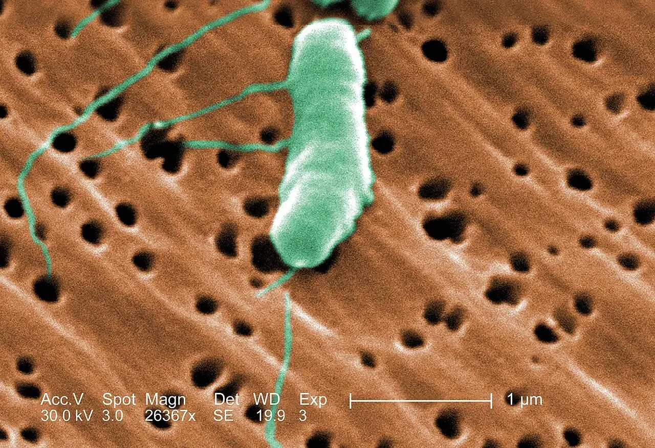 Farvelagt scanningselektronmikroskopi (SEM) af bakterien Vibrio vulnificus med tydelige flageller. Billedet illustrerer mikroorganismens overflade og struktur.