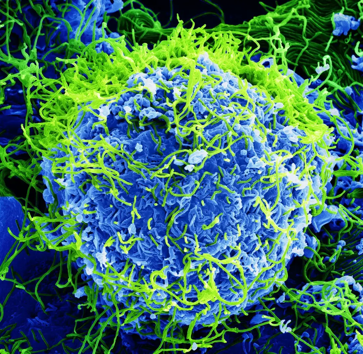 Electron microscope image of Ebola virus particles on a cell